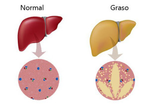 Higado-Graso-500x350